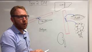 Type 2 Diabetes Pathophysiology [upl. by Henricks]