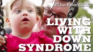 Down Syndrome Life [upl. by Asillem]