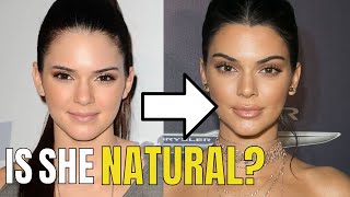 Kendall Jenner Plastic Surgery [upl. by Emmey]