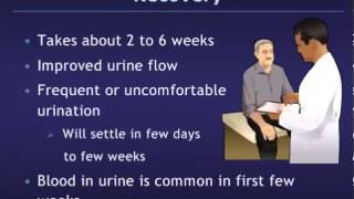 Transurethral Resection of the Prostate TURP [upl. by Ecineg306]