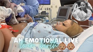 THE LIVE BIRTH OF OUR SECOND SET OF TWINS  Real Raw amp Emotional Doctor Turns Breech Baby in Womb [upl. by Gnilrac668]