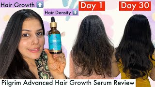 How I Went From Thin To Thick Hair In 30 Days  Pilgrim Advanced Hair Growth Serum Review [upl. by Adeuga79]