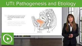 UTI Pathogenesis and Etiology with Case – Nephrology  Lecturio [upl. by Elik929]