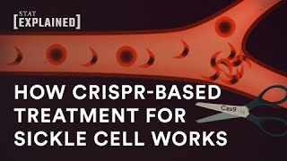 New CRISPRbased sickle cell treatment explained [upl. by Sudderth]