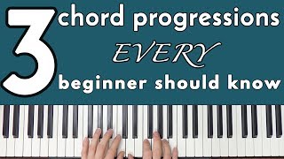 Common Chord Progressions Every Beginner Should Know [upl. by Onirefez]