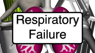 Nursing 101 Respiratory Failure [upl. by Elyad]