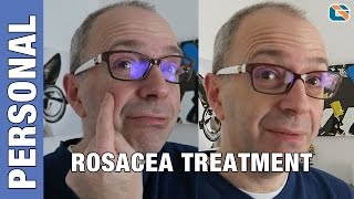 Rosacea Mirvaso Gel Cream Treatment Test  Geek Vlog 376 Rosacea [upl. by Nimesay]