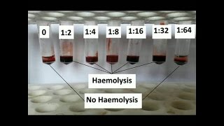 How to Determine antibody titer [upl. by Ozmo834]