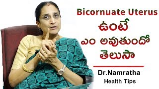 Bicornuate Uterus ఉంటే ఎం అవుతుందో తెలుసా  DrNamratha Health Tips  Health Qube [upl. by Vtarj490]