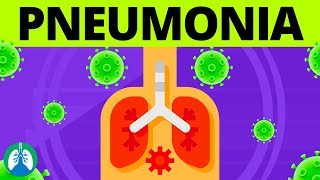 Pneumonia Overview  Causes Symptoms Diagnosis and Treatment [upl. by Haek]