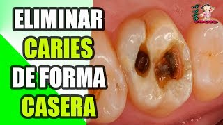 Cómo Eliminar Las Caries De Forma Casera Sin Ir Al Dentista 3 SIMPLES TRUCOS [upl. by Azeel122]