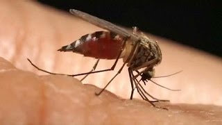 Wissenschaftlich bewiesen Zusammenhang zwischen ZikaVirus und Mikrozephalie [upl. by Conard]