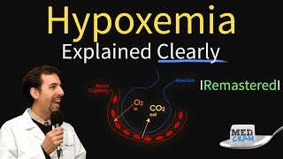 Hypoxemia  The 5 Causes amp Treatment 1 High Altitude [upl. by Bremer]