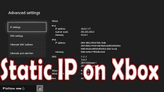 How to Setup Static IP on Xbox One [upl. by Anitahs61]