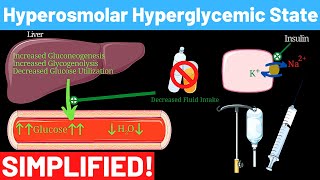 Hyperosmolar Hyperglycemic Nonketotic Syndrome  Panmedicad [upl. by Starling]