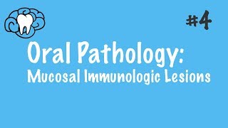 Oral Pathology  Mucosal Immunologic Diseases  INBDE ADAT [upl. by Eustache]