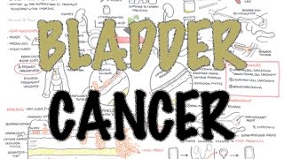 Throat Cancer Symptoms  Cancer Research UK [upl. by Lsil755]