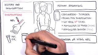 Diabetic Ketoacidosis Diabetes Type I Management Summary [upl. by Hannie20]