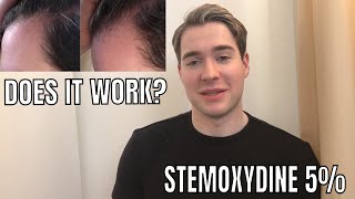 STEMOXYDINE 5 REVIEW  Kerastase Densifique Homme [upl. by Berhley]