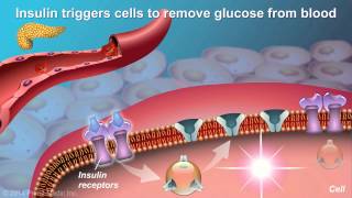 Understanding Type 2 Diabetes [upl. by Ecnirp]