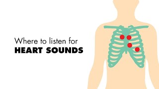 Where to listen for Heart Sounds Auscultory Areas  MEDZCOOL [upl. by Michel]