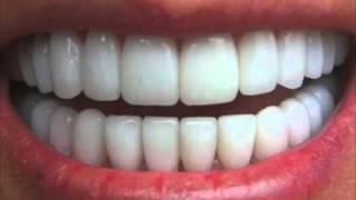 Get Perfectly Straight Teeth―∎ affirmations  Cure Overbite Underbite amp Crossbite [upl. by Horbal]