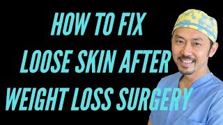 quotLoose Skin After Weight Loss SurgeryquotReal Talk With Dr V [upl. by Mohr]