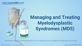 Managing and Treating MDS [upl. by Conlan327]