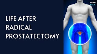 Life After Radical Prostatectomy [upl. by Brewer]