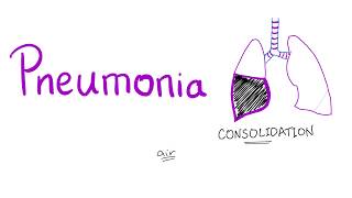 Pneumonia [upl. by Andrade977]