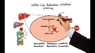 Cholesterol Treatment Guidelines and Clinical Applications in ACS Patients [upl. by Bixler]