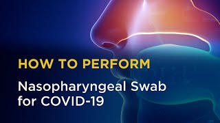 Nasopharyngeal Swab for COVID19 [upl. by Attenweiler589]