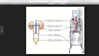 Continuous Renal Replacement Therapies CRRT [upl. by Nahgaem578]