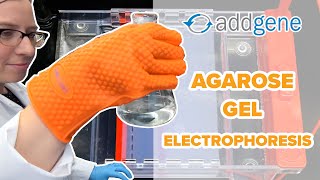 Agarose Gel Electrophoresis [upl. by Tamqrah418]