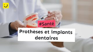 Prothèses et implants dentaires [upl. by Cornall]