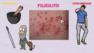 TRATAMIENTO PARA LA FOLICULITIS [upl. by Eivets]