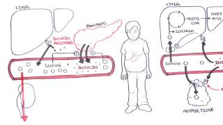 Diabetes Type II Pathophysiology [upl. by Aicilihp]