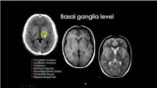 Basal ganglion anatomy [upl. by Kin296]