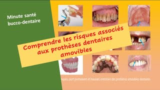 Risques de santé et protheses amovibles dentaires  health risks of Removables dentures prothesis [upl. by Ressler]