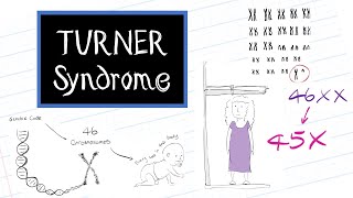 What is Turner Syndrome HealthSketch [upl. by Win]