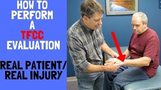 How to Perform a TFCC EvaluationReal patient real injury [upl. by Jar]