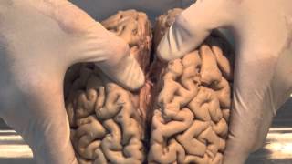 Introduction Neuroanatomy Video Lab  Brain Dissections [upl. by Enivid]