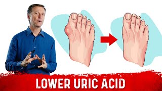 4 Ways to Neutralize Uric Acid [upl. by Drolyag184]