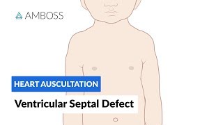 Ventricular Septal Defect VSD  Heart Auscultation  Episode 11 [upl. by Higginbotham84]