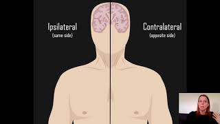 Ipsilateral vs Contralateral [upl. by Carmita]