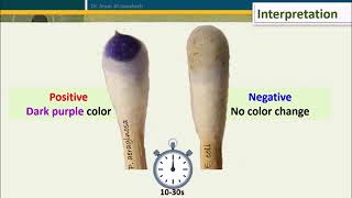 Oxidase Test Five Methods [upl. by Peder433]