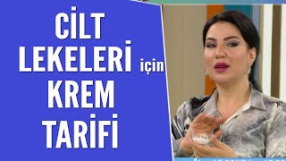 Cilt lekeleri için özel krem yapılışı ve tarifi [upl. by Africa]