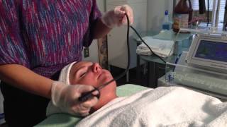 radio frequency ultra lift skin tightening [upl. by Noyk]