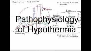 Hypothermia Pathophysiology [upl. by Yhtrod]