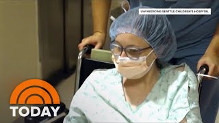 Survivor Of Conjoined Twin Surgery Gives Birth To Her Own Baby [upl. by Ordnajela]